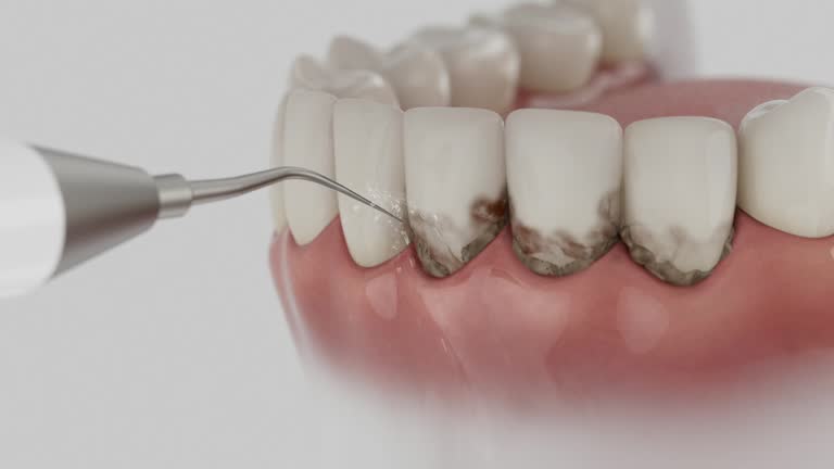 Reliable Tooth Extraction contractor in Crosby County County, TX by Dentist Open Now